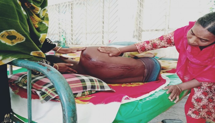 গোদাগাড়ীতে রিকশা চালককে গরম রড দিয়ে রাতভর নির্যাতন, গ্রেফতার ১