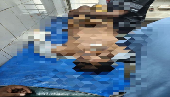 দুর্গাপুরে হত্যার জেরে আসামীকে পিটিয়ে হত্যা  